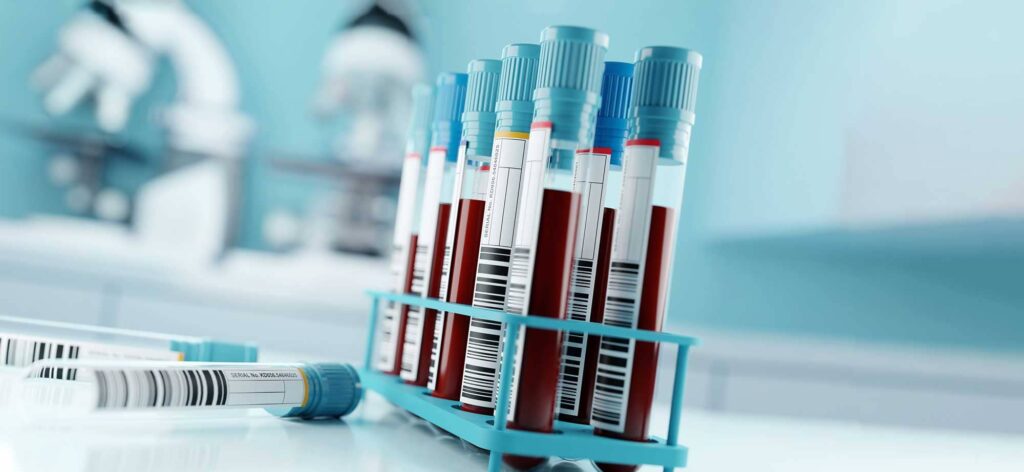 Vials of blood ready from lab draws waiting to be tested.